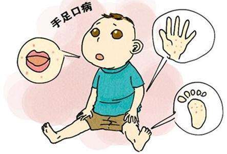 春意盎然，勿忘防治手足口